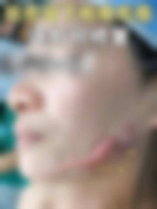 三、郭红磊技术优势