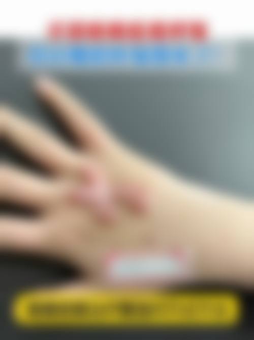 六、郭红磊真实的患者评价