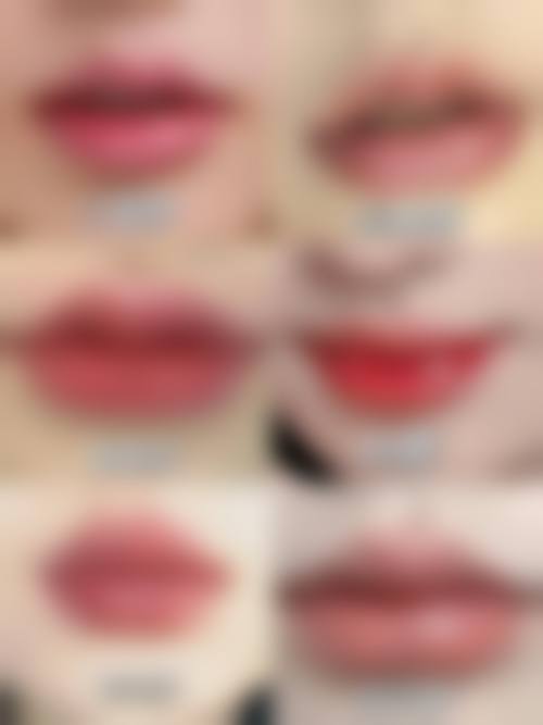 四、武汉奥黛丽整形医院特色项目