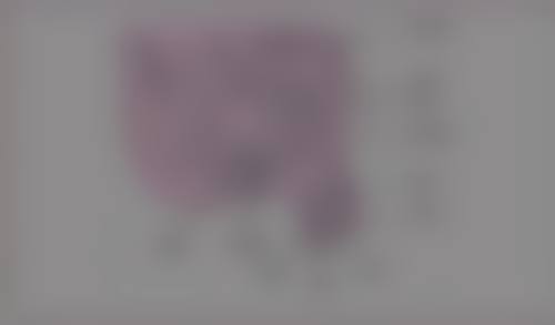 腿抽脂有没有副作用和危害？盘点常见风险与应对方法，助您安全塑形！ 