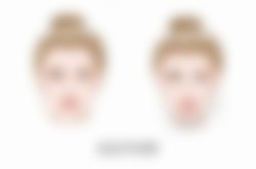 三、小时候烫伤的疤痕多种修复方法揭秘