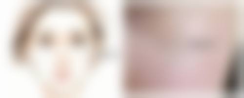 四、如何降低抽脂手术后遗症的风险