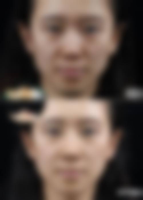 六、付红亮真实的患者评价