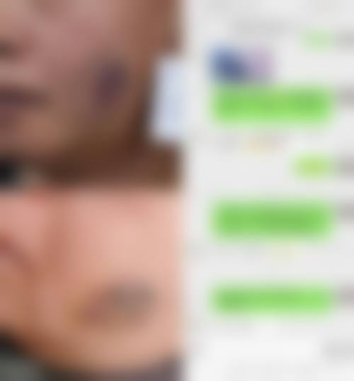 四、延安留美硕博医疗美容诊所特色项目