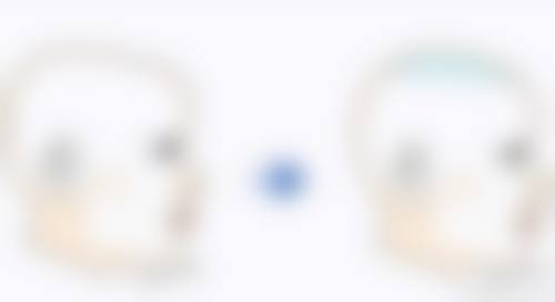 微球加胶原蛋白隆鼻是永久的吗？揭秘胶原微球注射隆鼻热门品牌及效果真相