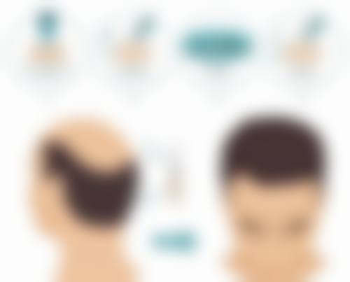 五、杨蔚怎么预约?