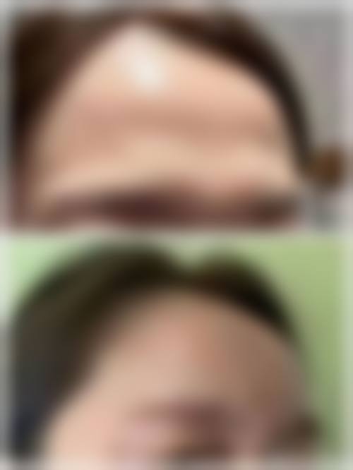 四、榆林亿安医院医学美容整形科特色项目