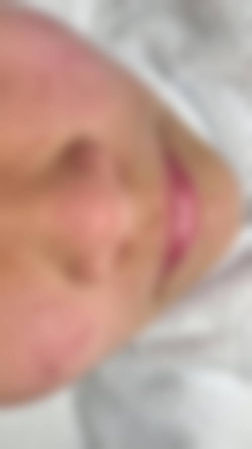 八、榆林亿安医院医学美容整形科真实的患者评价