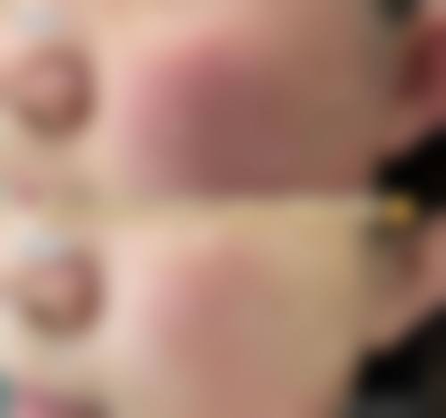 四、日本Mods美容外科医院特色项目