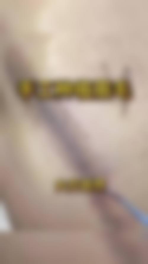 八、中山美辰医疗美容门诊部真实的患者评价