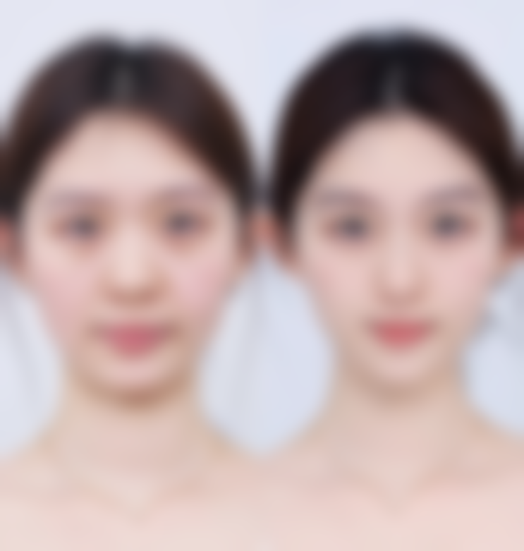 九、长春一妍针美整形医院真实的患者评价