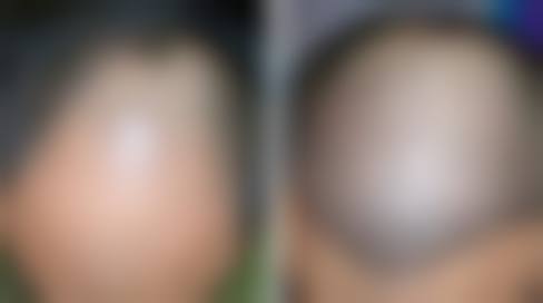 四、成都艾凡加医疗美容门诊部特色项目