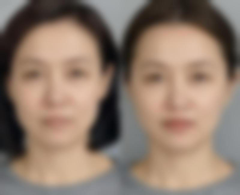 每天按摩眼袋能去除吗？女生必知，按摩对眼袋的作用及科学改善方案 