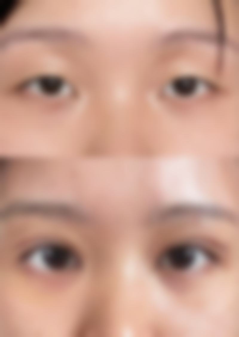 一、每天按摩眼袋能去除吗：答案揭晓