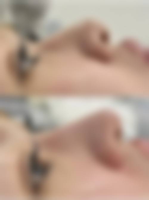 四、佛山典燃医疗美容诊所特色项目