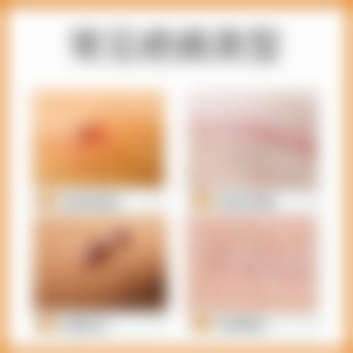 五、金哉勋怎么预约?