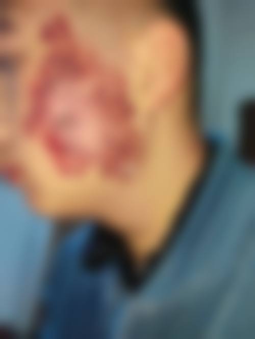 八、新疆乌鲁木齐悦尚容医疗美容医院真实的患者评价