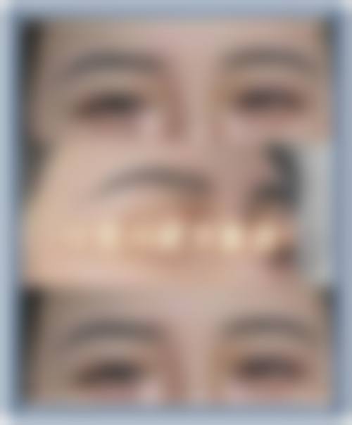 六、佛山典燃医疗美容诊所价格表