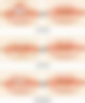 八、监利白衣天使医疗美容诊所真实的患者评价