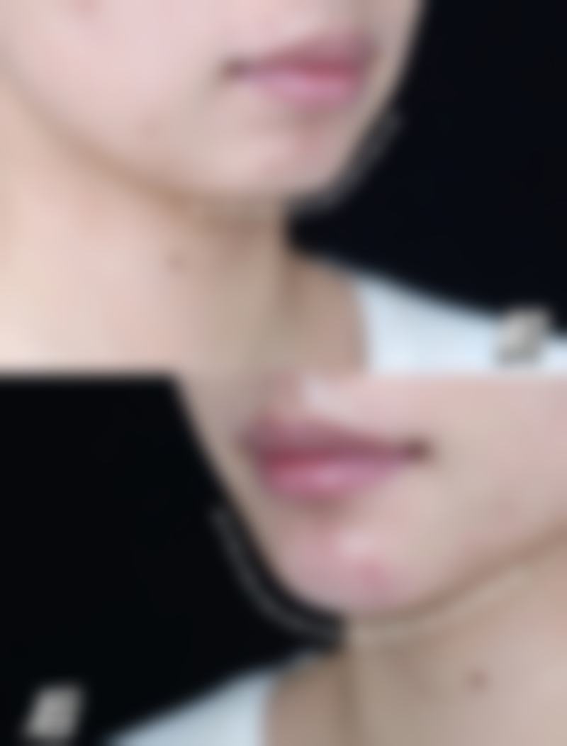 二、新疆乌鲁木齐悦尚容医疗美容医院怎么样?