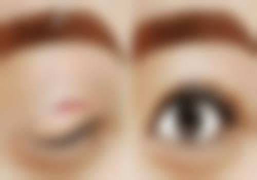 八、深圳柒薇整形医院真实的患者评价