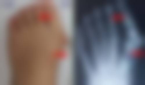 五、方建苗怎么预约？