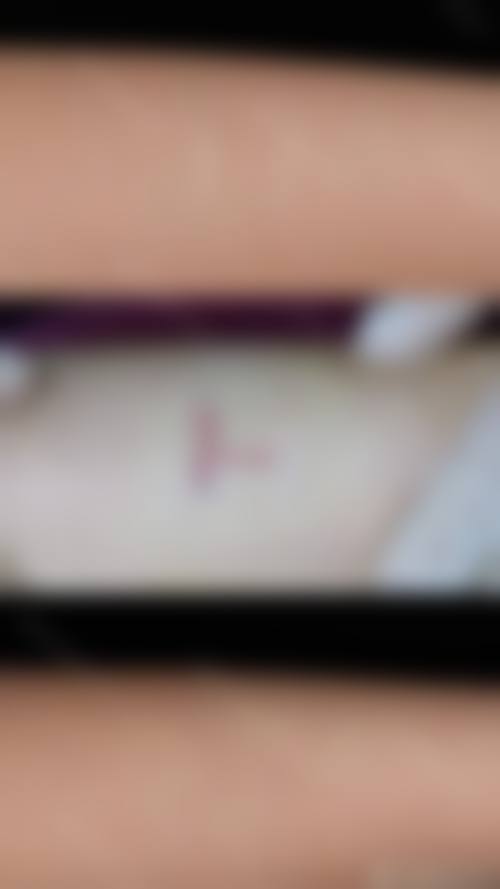 三、韩国清心丽延长整形医院诊疗项目有哪些？