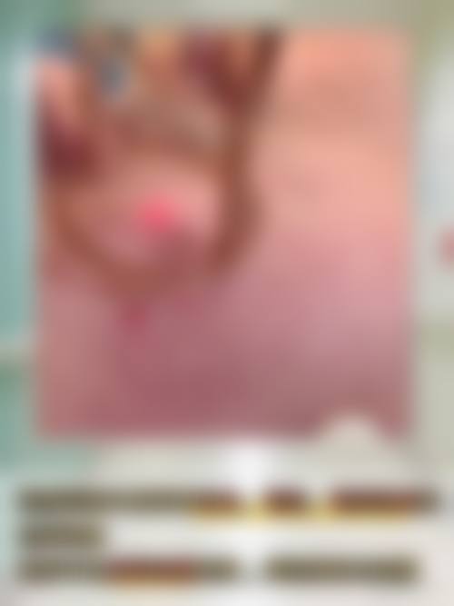 五、张靖晨怎么预约？