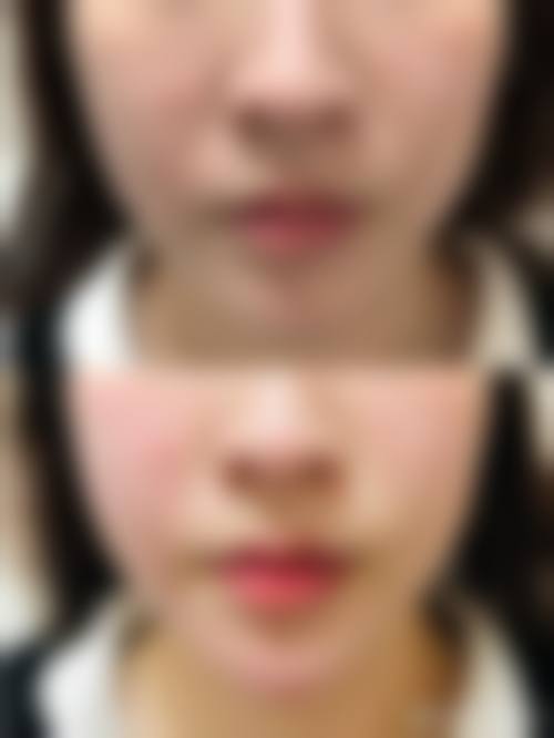 八、济宁丽珍医疗美容医院真实的患者评价