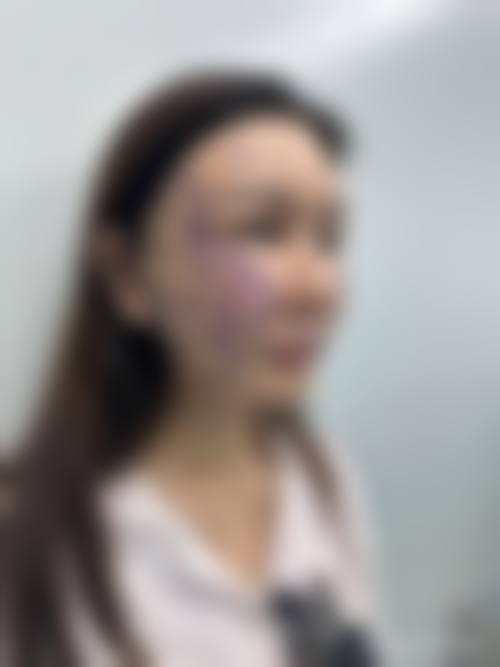 四、韩国清心丽延长整形医院特色项目