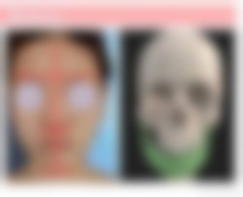 七、韩国清心丽延长整形医院预约方式