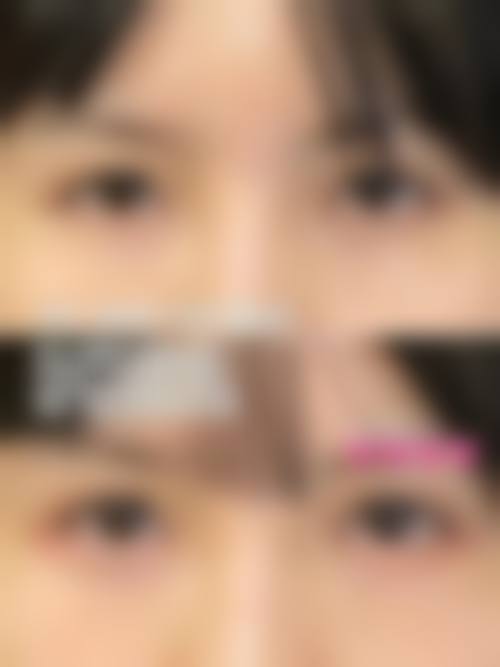 五、深圳柒薇整形医院价格表