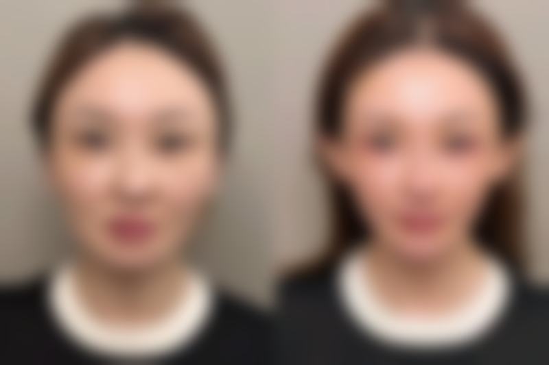 四、药物使用注意事项