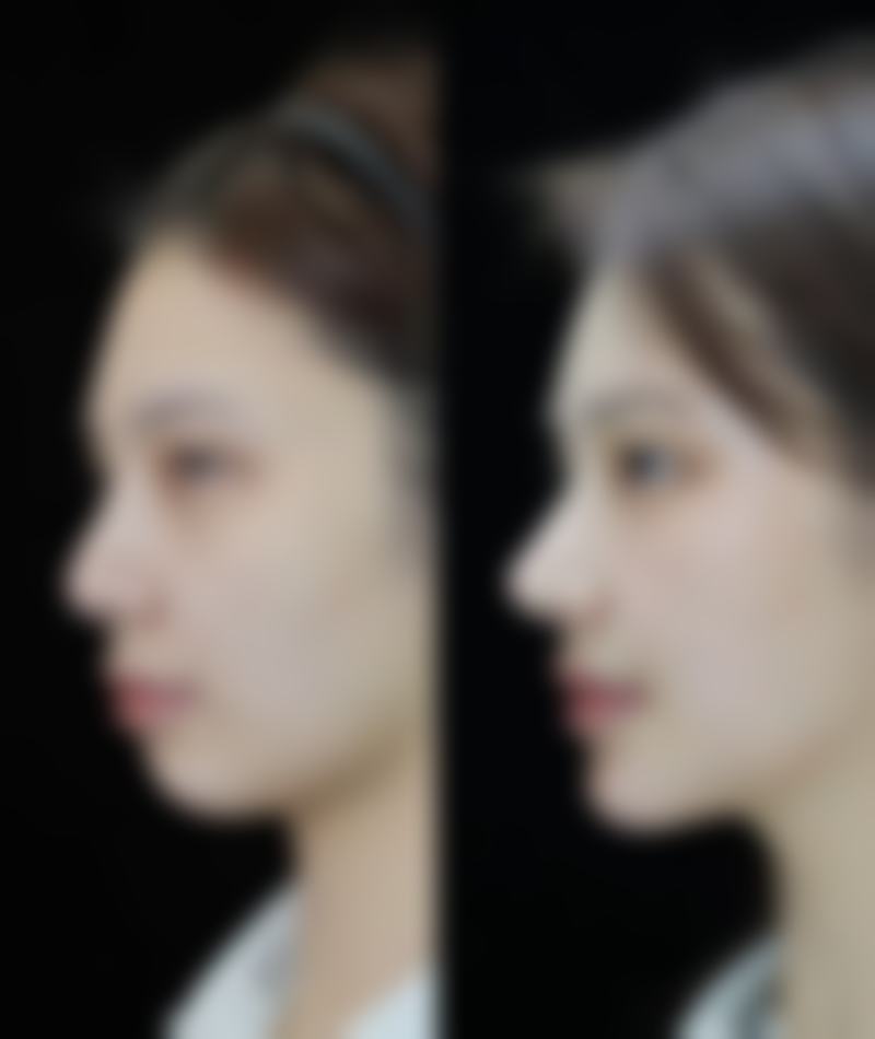 四、深圳柒薇整形医院特色项目