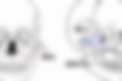 四、做什么双眼皮更好更安心之术中操作注意事项