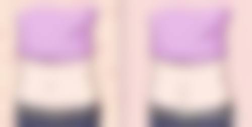 二、做什么双眼皮更好更安心之各术式优劣势对比