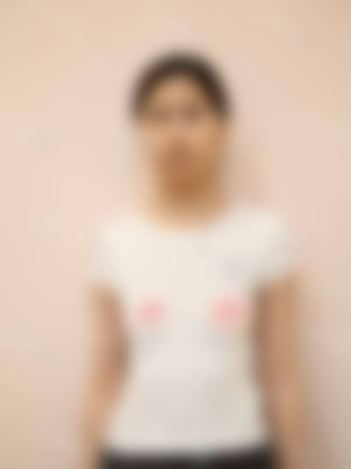 八、盐城东方女子整形医院真实的患者评价