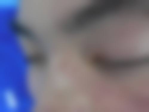 三、广州粤秀整形外科诊疗项目有哪些？