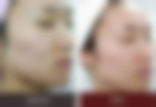 八、广州粤秀整形外科真实的患者评价