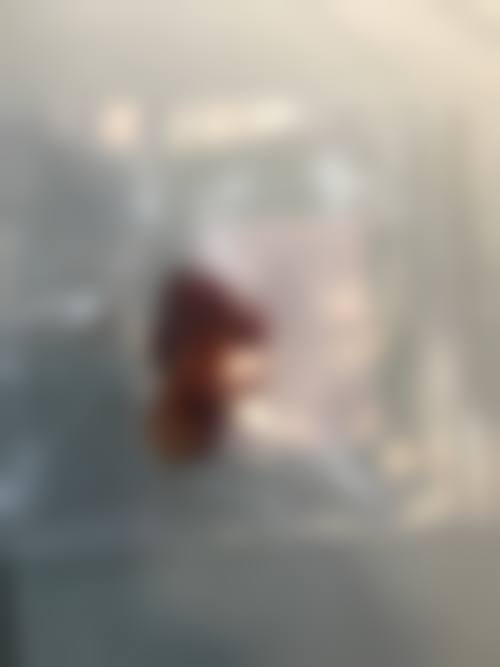 二、广州粤秀整形外科怎么样？