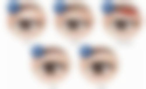 八、长沙肌肤之亲医疗美容皮肤诊所真实的患者评价