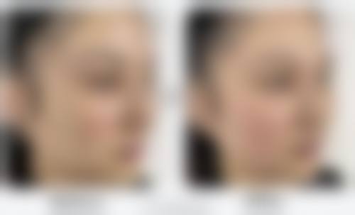 四、盐城东方女子整形医院特色项目