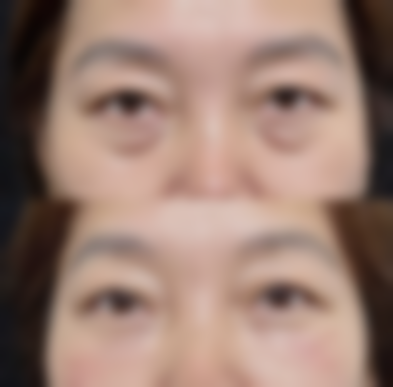 四、不同后遗症的修复周期