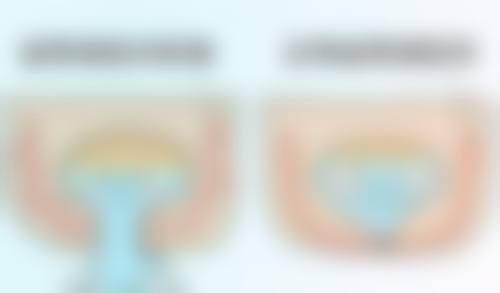 七、结论：宁静的双眼皮是割的吗？