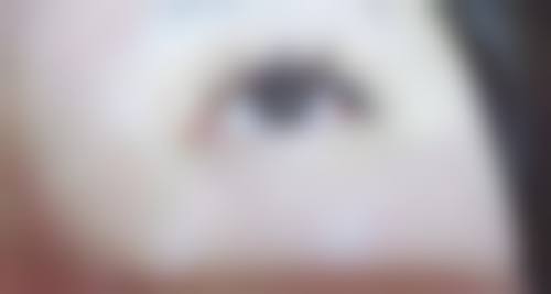 九、玉林贞韩植发医疗美容诊所真实的患者评价