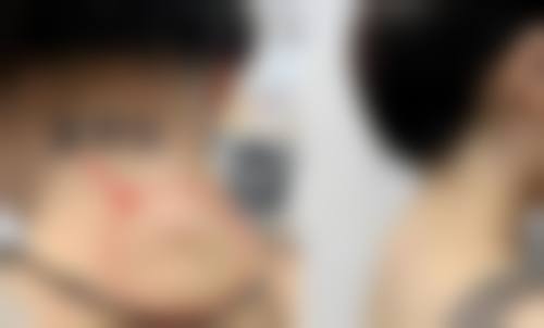 五、海口伊美汇医疗美容诊所价格表