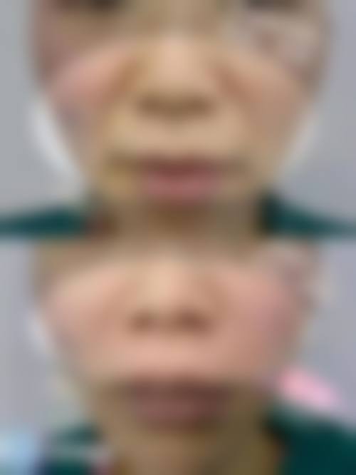 八、海口伊美汇医疗美容诊所真实的患者评价