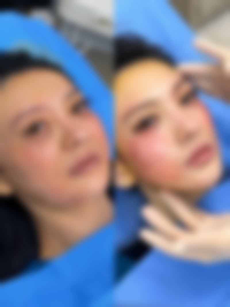 二、影响隆胸成效持久性的关键因素