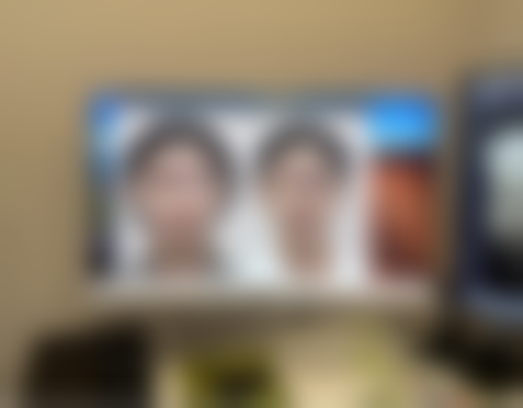 四、日常护理要点