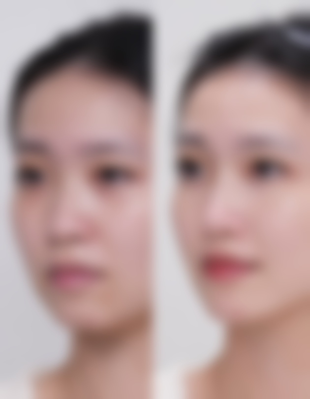 三、不同方案的适用阶段及注意事项